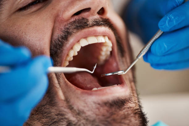 Emergency Dentist Open Today in NY